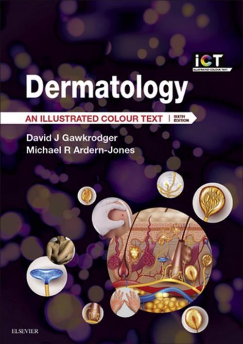 Cover of the book Dermatology E-Book by David Gawkrodger, DSc, MD, FRCP, FRCPE, Michael R Ardern-Jones, BSc, MBBS, FRCP, DPhil, Elsevier Health Sciences