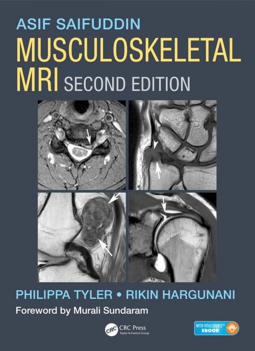 Cover of the book Musculoskeletal MRI by Asif Saifuddin, Philippa Tyler, Rikin Hargunani, CRC Press