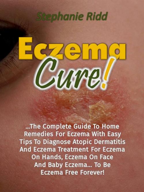 Cover of the book Eczema Cure!: The Complete Guide To Home Remedies For Eczema With Easy Tips To Diagnose Atopic Dermatitis And Eczema Treatment For Eczema On Hands, Eczema On Face And Baby Eczema... To Be Eczema Free by Stephanie Ridd, Eljays-epublishing