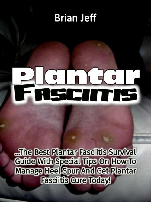 Cover of the book Plantar Fasciitis: The Best Plantar Fasciitis Survival Guide With Special Tips On How To Manage Heel Spur And Get Plantar Fasciitis Cure Today! by Brian Jeff, Eljays-epublishing