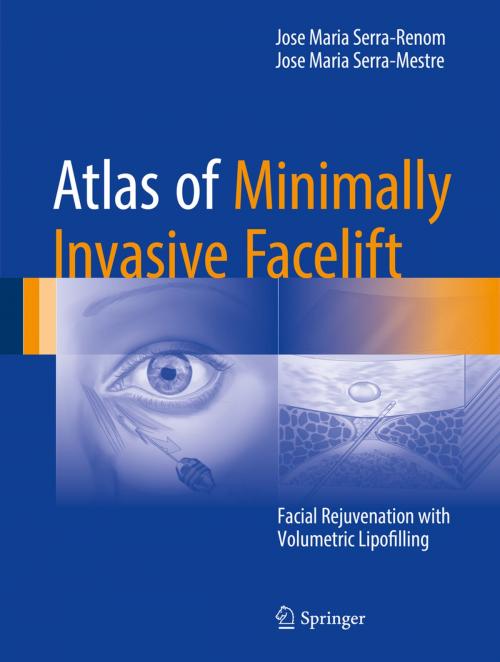 Cover of the book Atlas of Minimally Invasive Facelift by Jose Maria Serra-Renom, Jose Maria Serra-Mestre, Springer International Publishing