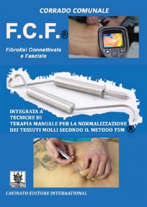 Cover of the book F.C.F - Fibrosi Connettivale e Fasciale by Corrado Comunale, Cavinato Editore