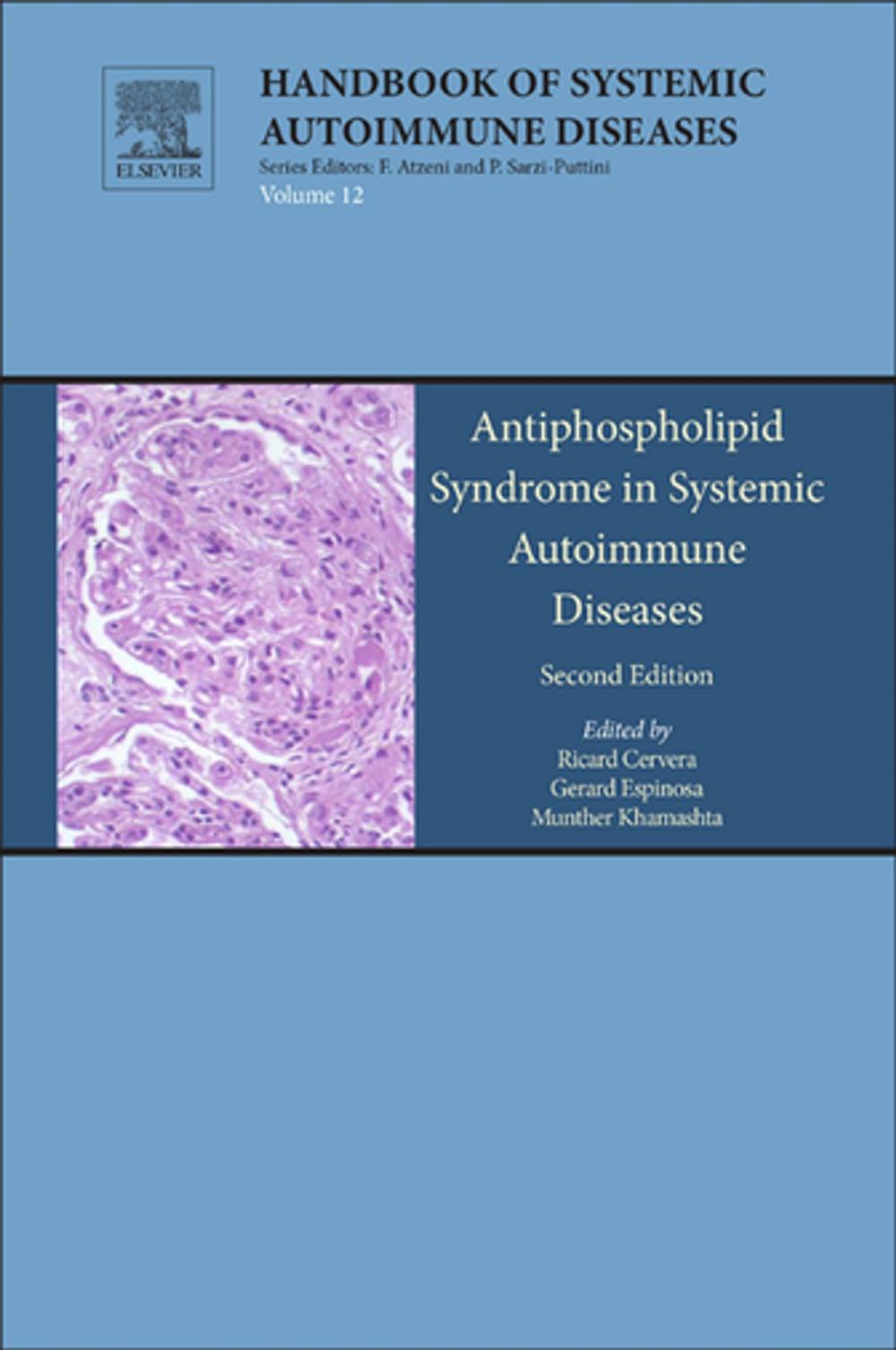 Big bigCover of Antiphospholipid Syndrome in Systemic Autoimmune Diseases
