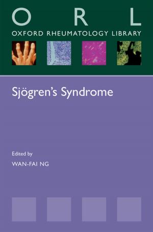 Cover of the book Sjögren's Syndrome by Robert C. Baldwin