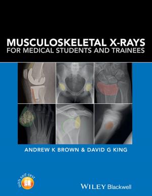 bigCover of the book Musculoskeletal X-Rays for Medical Students and Trainees by 