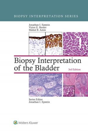 Cover of the book Biopsy Interpretation of the Bladder by Robert R. Simon, Christopher Ross, Steven H. Bowman, Pierre E. Wakim