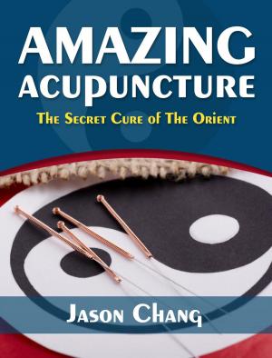 Book cover of Amazing Acupuncture The Secret Cure of The Orient