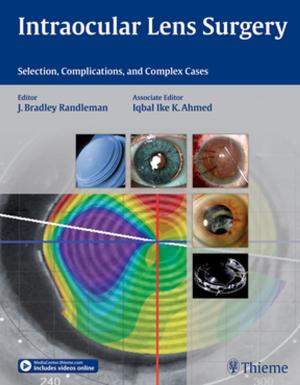 Cover of the book Intraocular Lens Surgery by Wolfgang Dauber