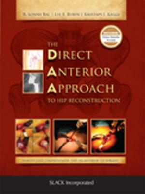 Cover of The Direct Anterior Approach to Hip Reconstruction