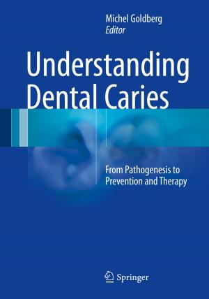 Cover of the book Understanding Dental Caries by Pongsak Hoontrakul