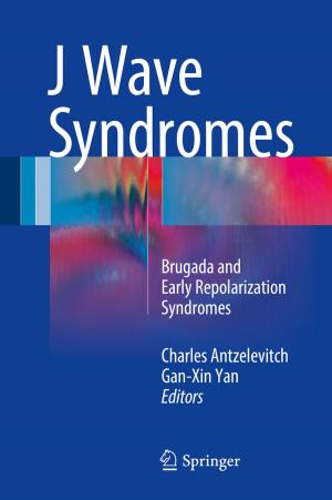 Cover of the book J Wave Syndromes by David S.A. Simakov