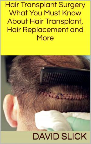 Cover of the book Hair Transplant Surgery by Chaun Conscious