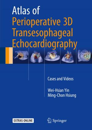Cover of the book Atlas of Perioperative 3D Transesophageal Echocardiography by Ying Wu, Yong Gao