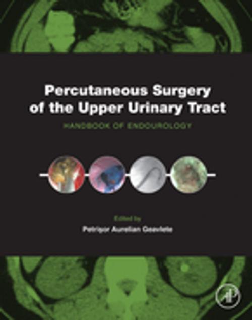 Cover of the book Percutaneous Surgery of the Upper Urinary Tract by , Elsevier Science