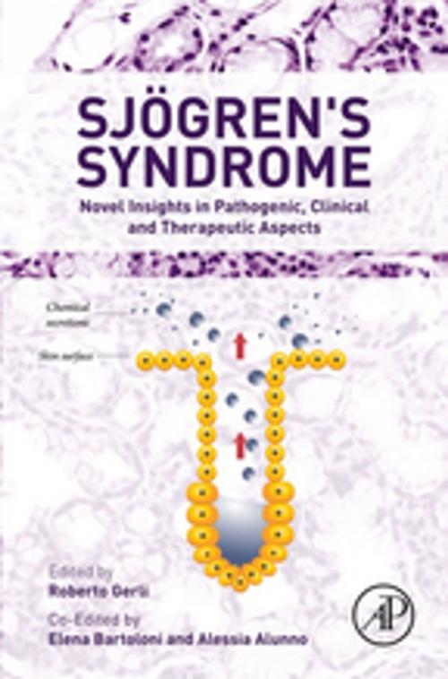 Cover of the book Sjogren's Syndrome by , Elsevier Science