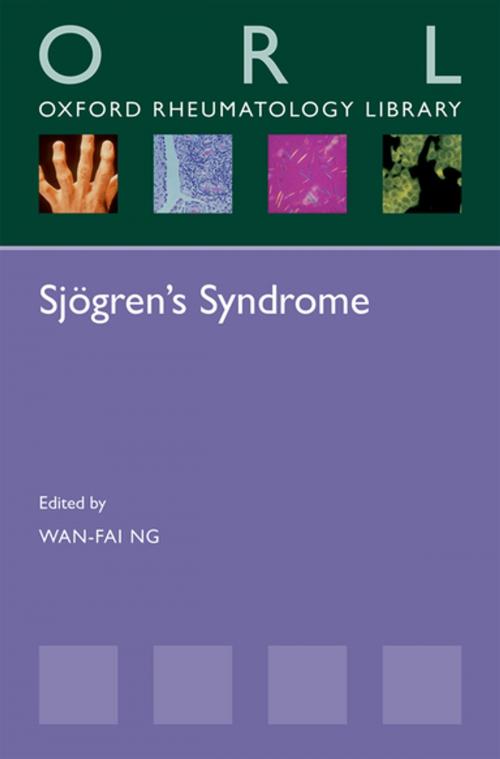 Cover of the book Sjögren's Syndrome by , OUP Oxford