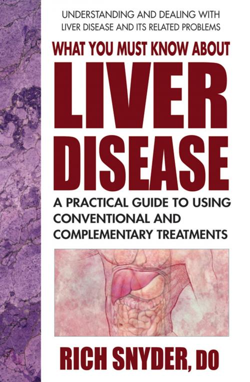 Cover of the book What You Must Know About Liver Disease by Rich Snyder, DO, Square One Publishers