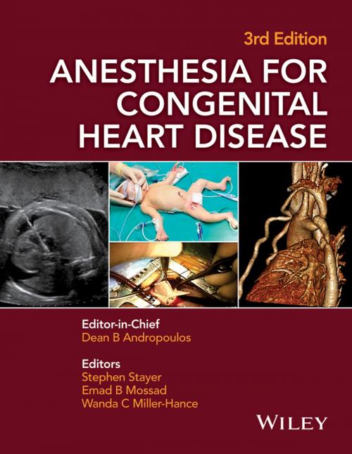 Cover of the book Anesthesia for Congenital Heart Disease by Dean B. Andropoulos, Wiley