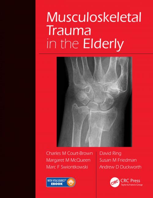 Cover of the book Musculoskeletal Trauma in the Elderly by , CRC Press
