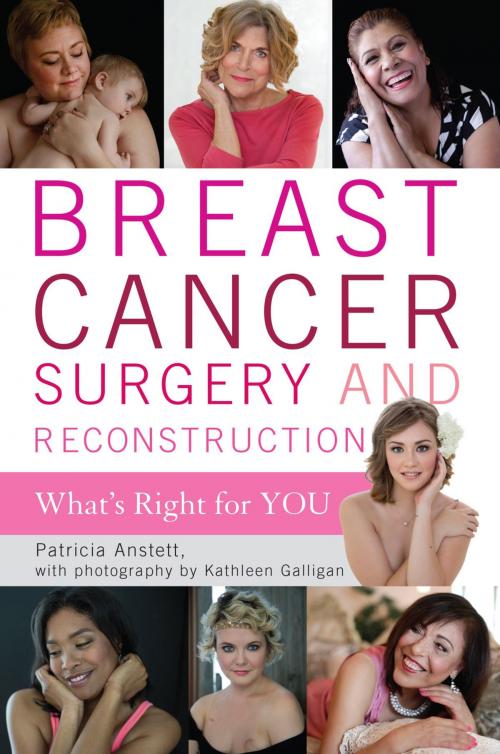 Cover of the book Breast Cancer Surgery and Reconstruction by Patricia Anstett, Rowman & Littlefield Publishers