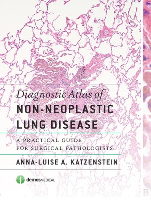 Cover of the book Diagnostic Atlas of Non-Neoplastic Lung Disease by Anna-Luise A. Katzenstein, MD, Springer Publishing Company