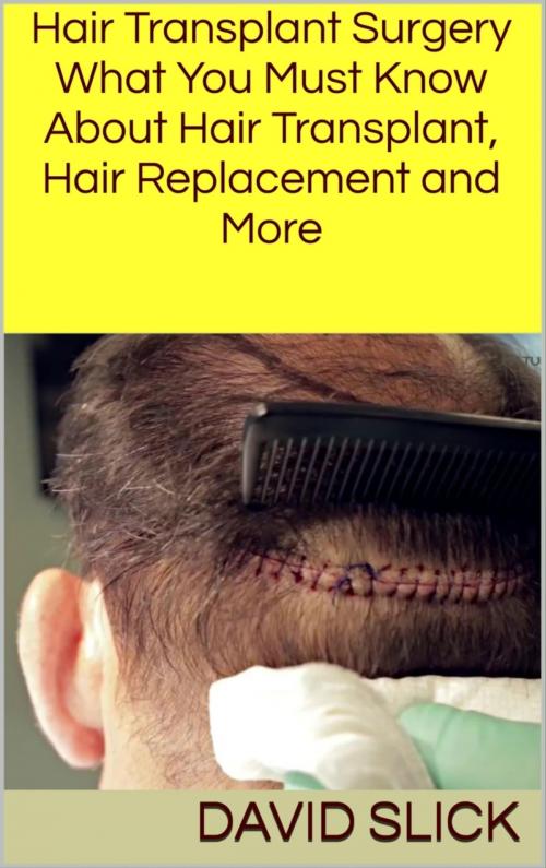 Cover of the book Hair Transplant Surgery by David Slick, BookRix