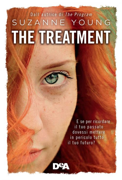 Cover of the book The treatment by Suzanne Young, De Agostini