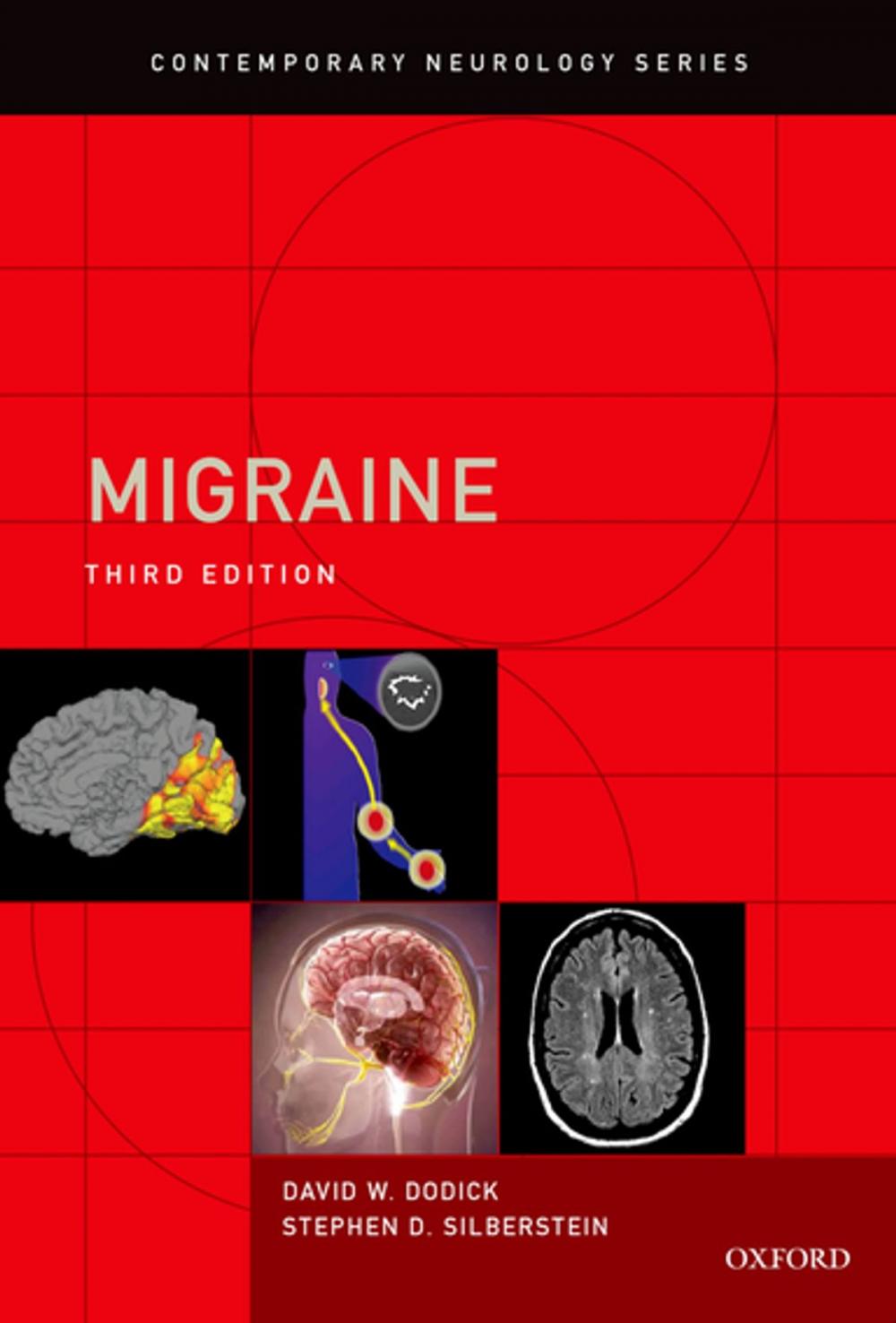 Big bigCover of Migraine