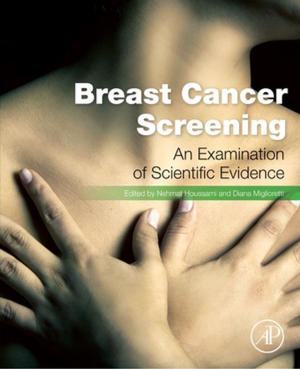 Cover of the book Breast Cancer Screening by V. Chiles, S. Black, A. Lissaman, S. Martin