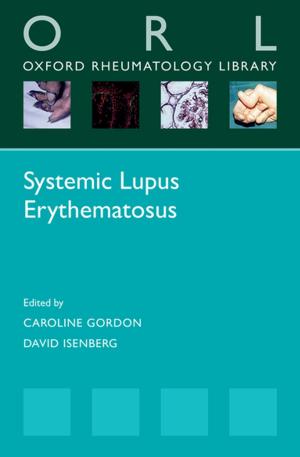 Cover of the book Systemic Lupus Erythematosus by José Casanova