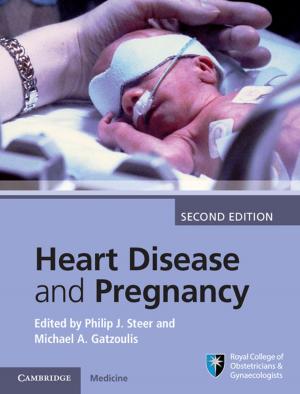 Cover of the book Heart Disease and Pregnancy by Mechele Dickerson