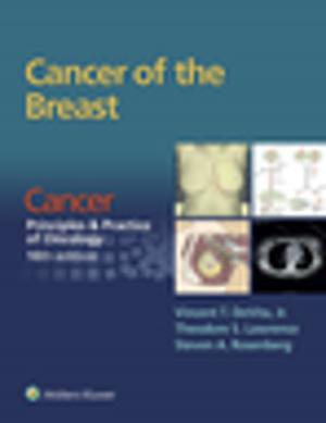 Cover of the book Cancer of the Breast by Andrea M. Kline, Catherine Haut