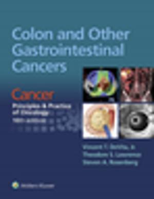 Book cover of Colon and Other Gastrointestinal Cancers