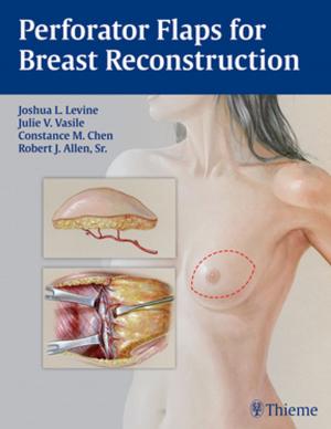 Cover of the book Perforator Flaps for Breast Reconstruction by Laszlo Tabar, Tibor Tot, Peter B. Dean