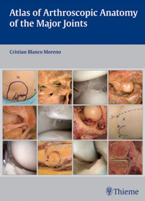 Cover of the book Atlas of Arthroscopic Anatomy of Major Joints by John C. Morrison, Irvin P. Pollack