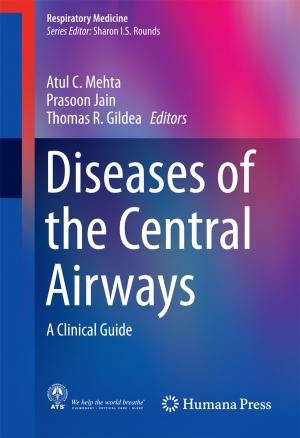 Cover of the book Diseases of the Central Airways by Robert L. Shewfelt
