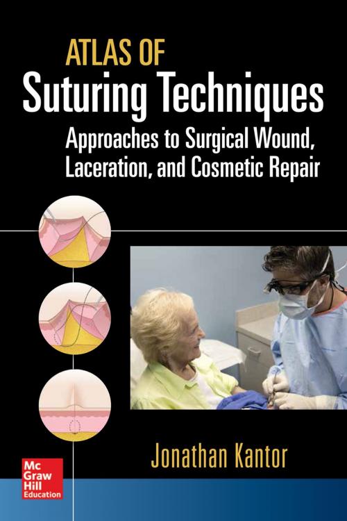 Cover of the book Atlas of Suturing Techniques: Approaches to Surgical Wound, Laceration, and Cosmetic Repair by Jonathan Kantor, McGraw-Hill Education