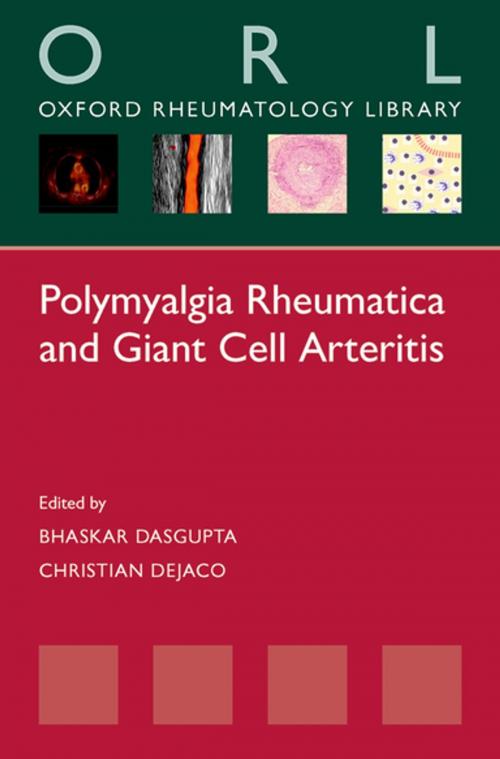 Cover of the book Polymyalgia Rheumatica and Giant Cell Arteritis by , OUP Oxford