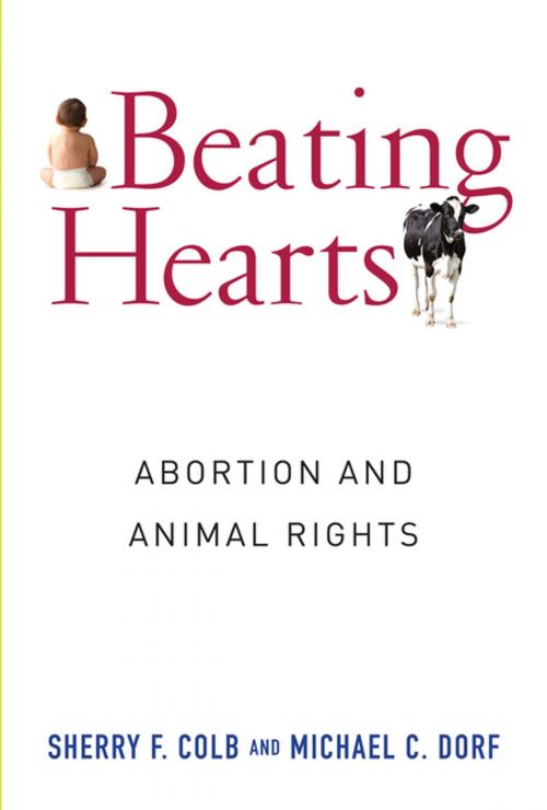 Cover of the book Beating Hearts by Sherry Colb, Michael Dorf, Columbia University Press
