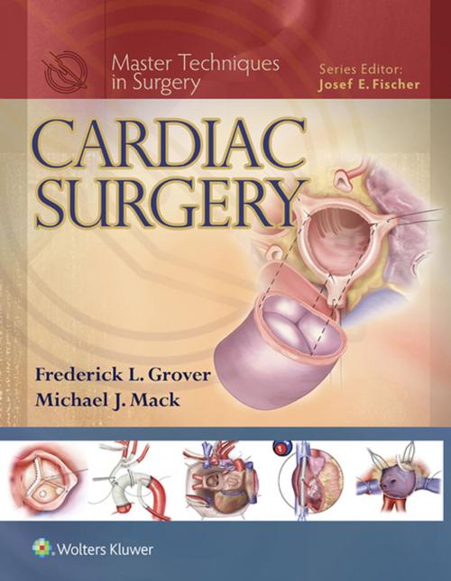 Cover of the book Master Techniques in Surgery: Cardiac Surgery by Frederick Grover, Michael J. Mack, Wolters Kluwer Health