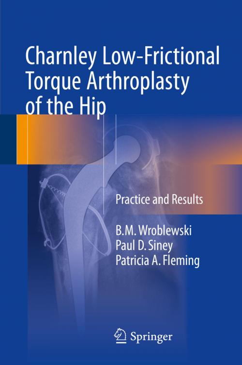 Cover of the book Charnley Low-Frictional Torque Arthroplasty of the Hip by Paul D. Siney, B.M. Wroblewski, Patricia A. Fleming, Springer International Publishing