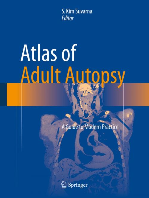 Cover of the book Atlas of Adult Autopsy by , Springer International Publishing