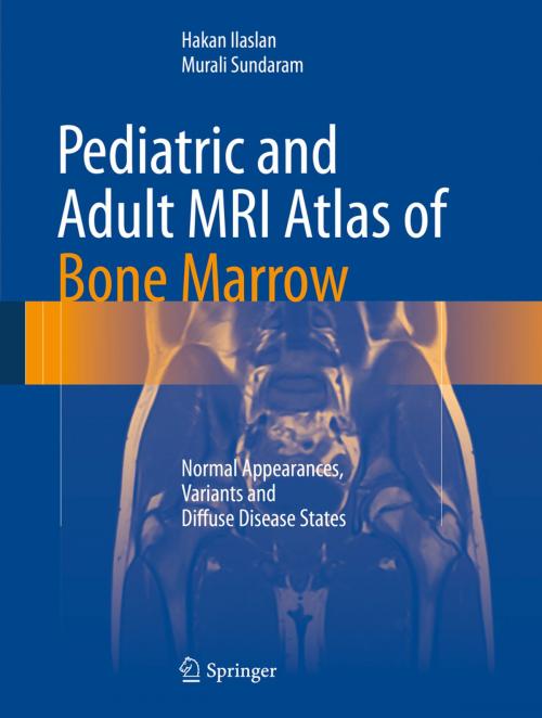 Cover of the book Pediatric and Adult MRI Atlas of Bone Marrow by Hakan Ilaslan, Murali Sundaram, Springer Berlin Heidelberg