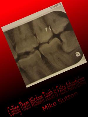 Cover of the book Calling them Wisdom Teeth is False Advertising by Sylvia Green