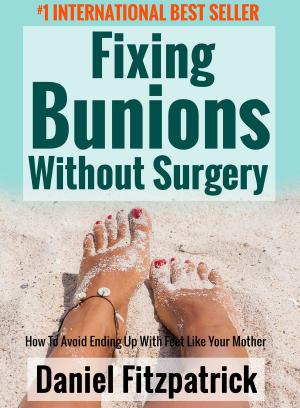 Cover of the book Fixing Bunions Without Surgery: How To Avoid Ending Up With Feet Like Your Mother by Harun Yahya