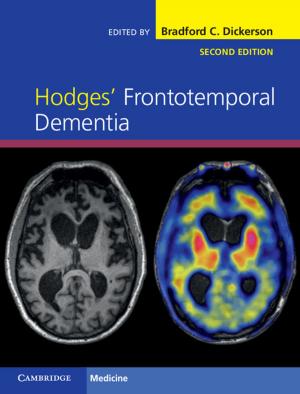 Cover of the book Hodges' Frontotemporal Dementia by Randall C. Zachman