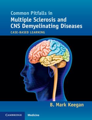 Cover of the book Common Pitfalls in Multiple Sclerosis and CNS Demyelinating Diseases by Steven T. Katz