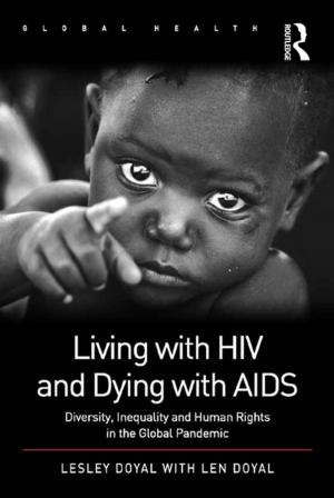 Cover of the book Living with HIV and Dying with AIDS by J.W.H. Mackay