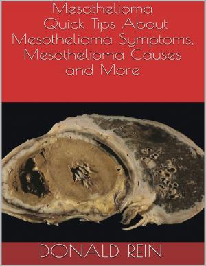 Cover of the book Mesothelioma: Quick Tips About Mesothelioma Symptoms, Mesothelioma Causes and More by Jim White