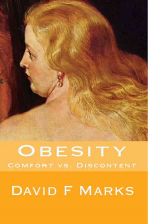 Cover of the book Obesity by Jaden Austin
